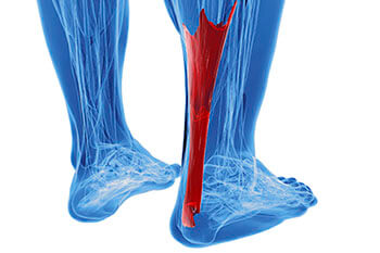 Achilles tendonitis treatment in the San Antonio, TX 78224, Uvalde, TX 78801 and Jourdanton, TX 78026 areas