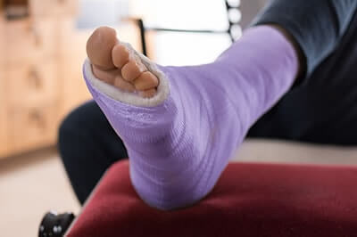 Foot Fractures treatment in the San Antonio, TX 78224, Uvalde, TX 78801 and Jourdanton, TX 78026 areas
